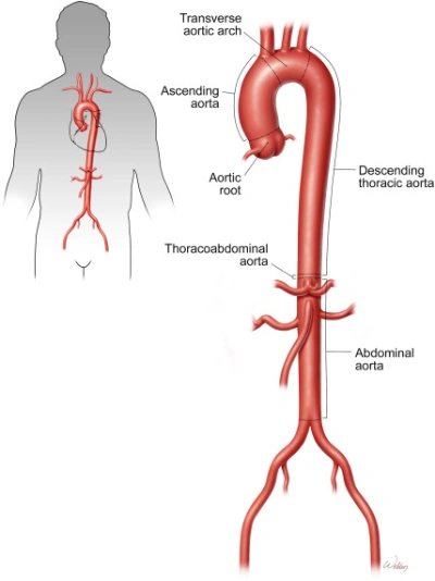 Descending Aorta